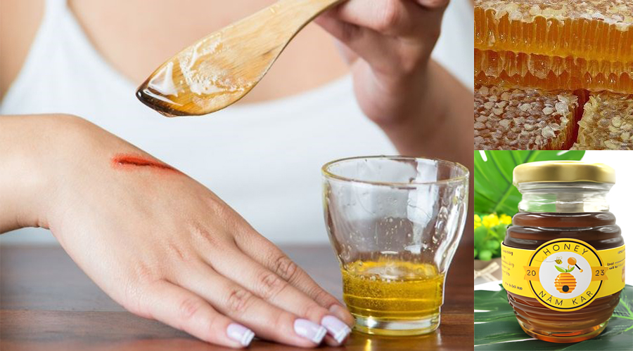 Chữa bỏng, làm lành vết thương mat ong nam kar nongsanxanhnamkar vn